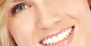 Invisalign treatment